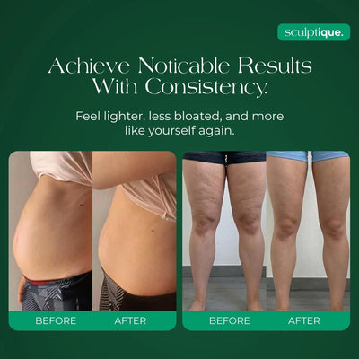 Lymphatic Drainage Capsules by Sculptique™